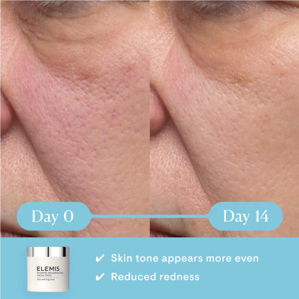 Elemis Dynamic Resurfacing Facial Pads 60pk DestGlow