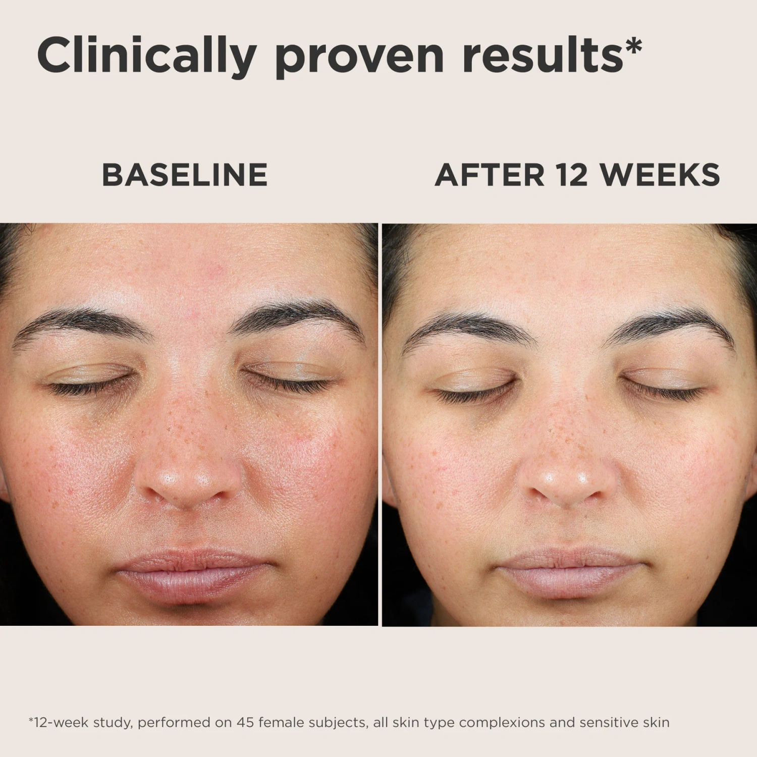 EltaMD UV Skin Recovery Red Color Correcting Green Tint Broad Spectrum SPF 50 - DestGlow