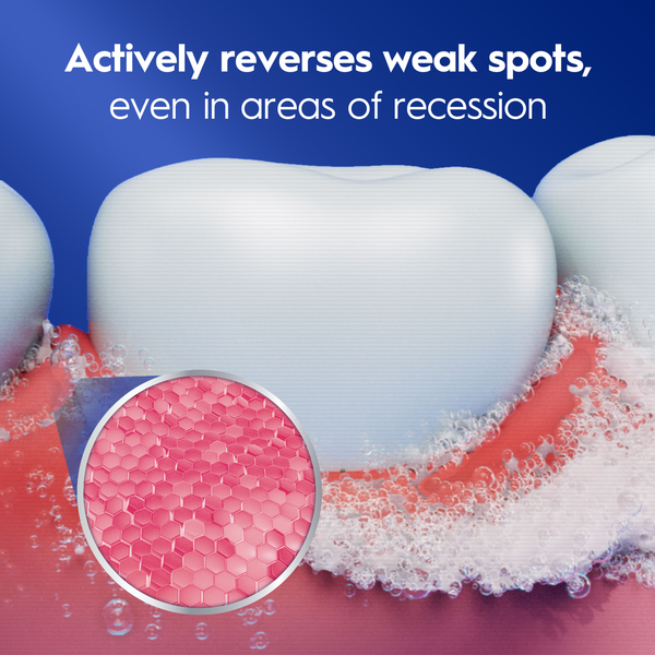 Crest Gum Recession Toothpaste 2.5 oz - Gum Protection even in areas of recession