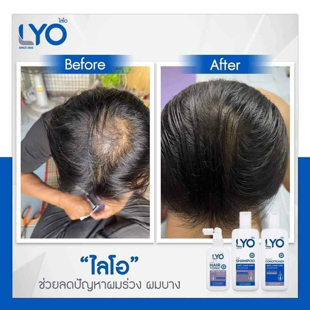 LYO Shampoo Conditioner Anti Hair Loss 200 ml