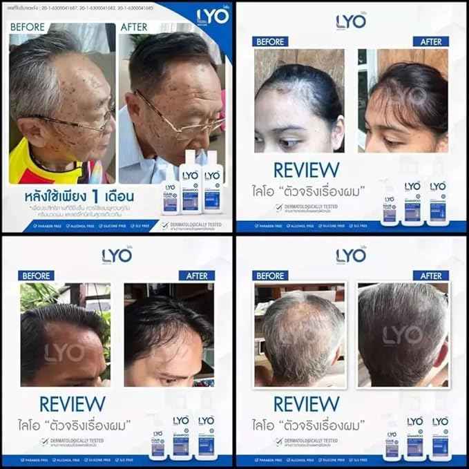 LYO Shampoo Conditioner Anti Hair Loss 200 ml