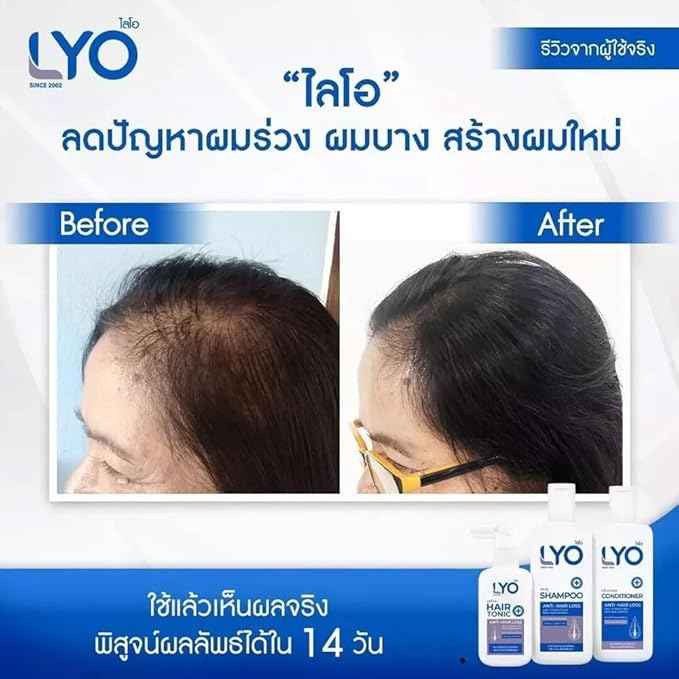 LYO Shampoo Conditioner Anti Hair Loss 200 ml