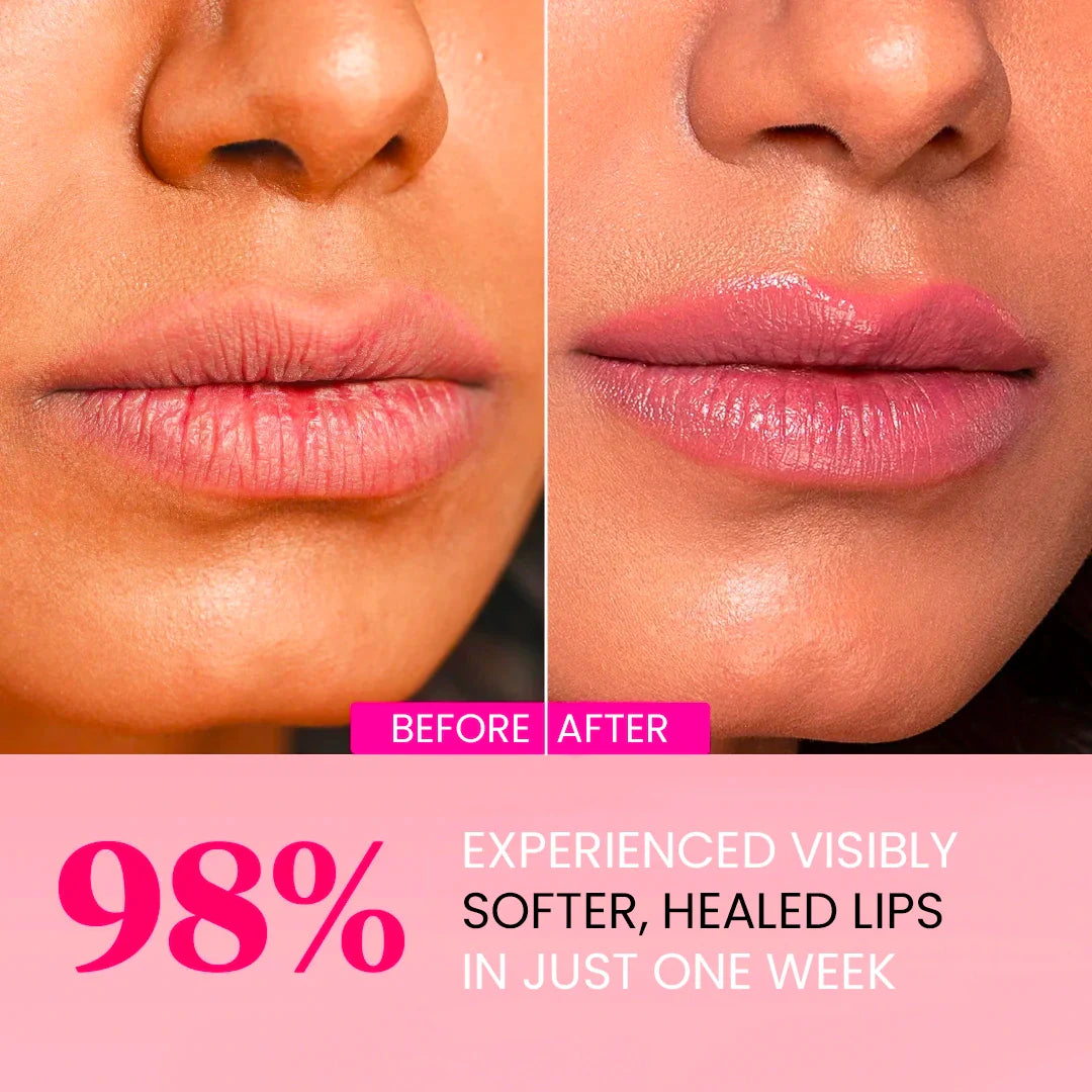 Plumping Lip Masks - Collagen, Hyaluronic Acid, Centella Asiatica - DestGlow