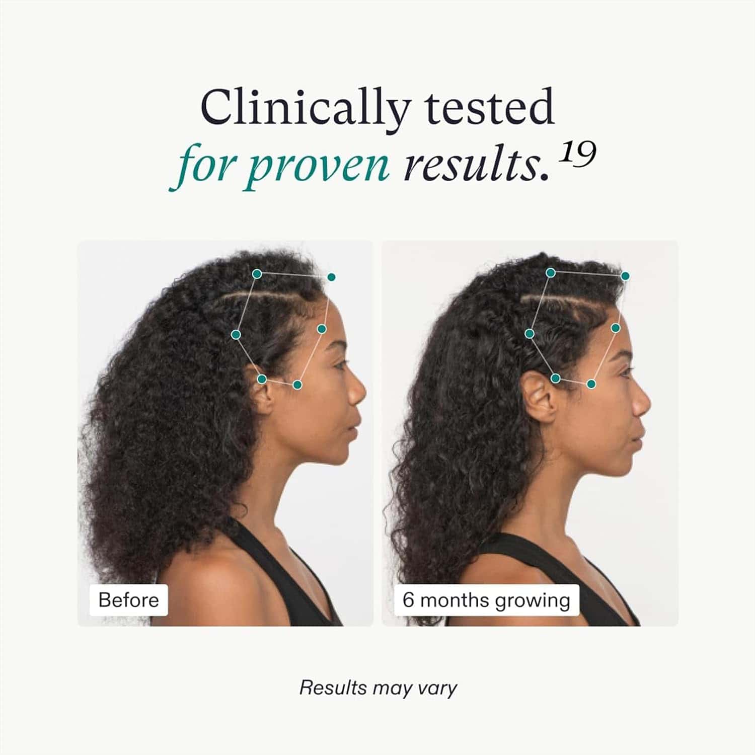 Nutrafol Women&