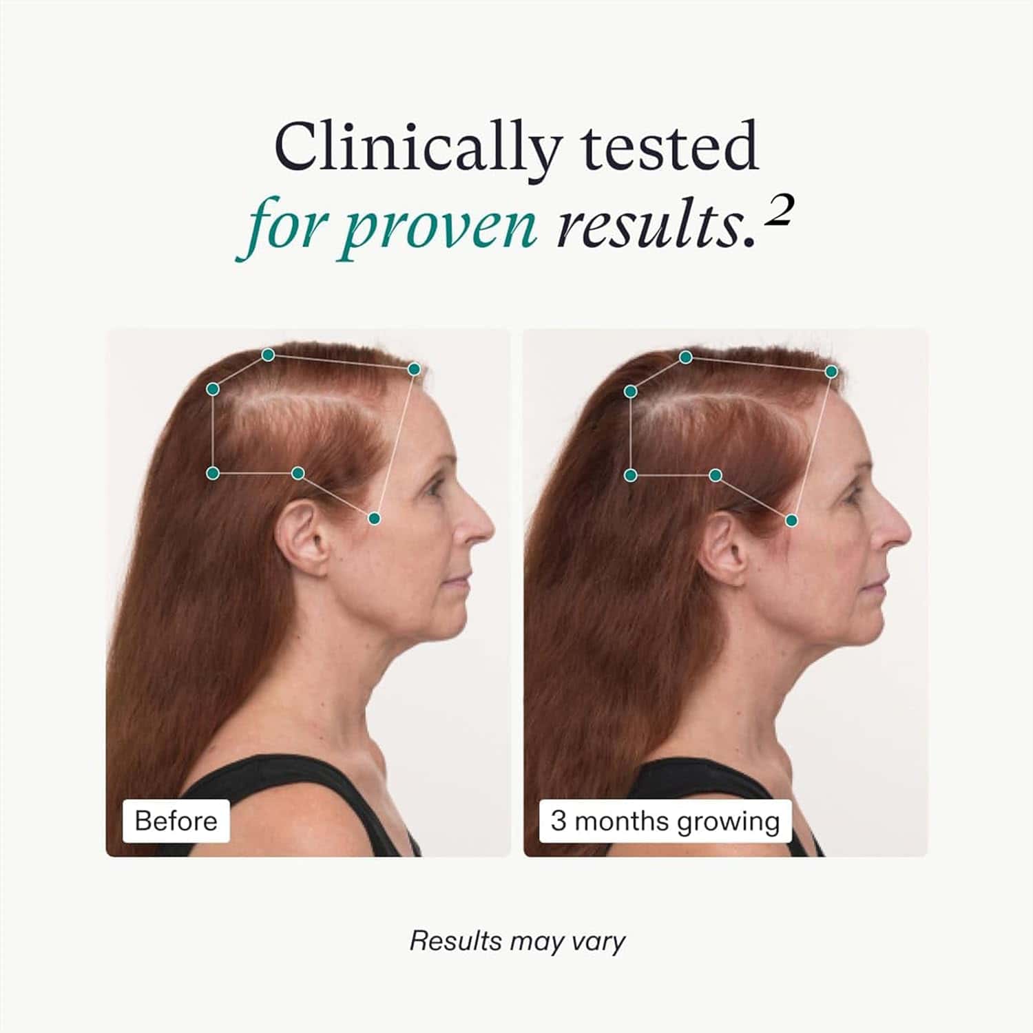 Nutrafol Women&