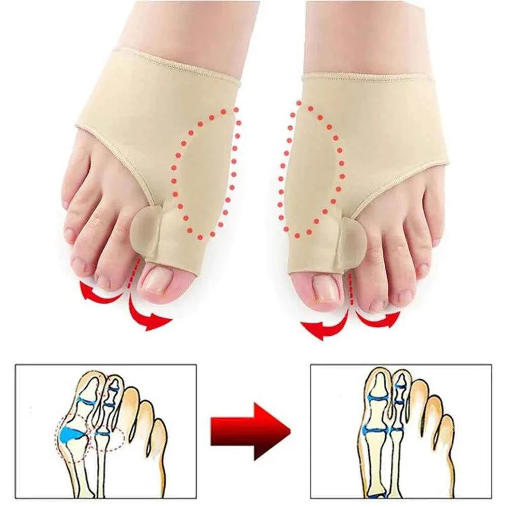 ToeAlign™ Orthopedic Toe Separators – Bunion Relief & Foot Alignment Support