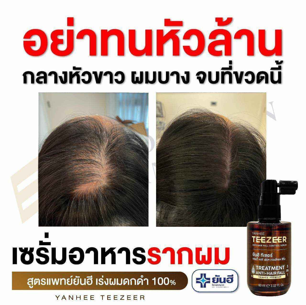 Yanhee Teezeer Shampoo 200 ml