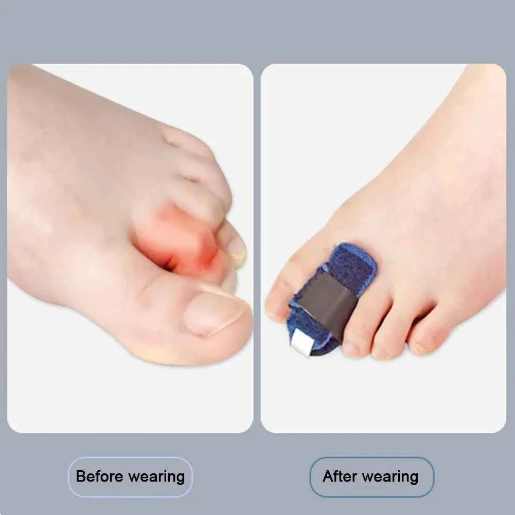 HammerToeFix™ Toe Splint Straightener – Hammer Toe Relief & Alignment