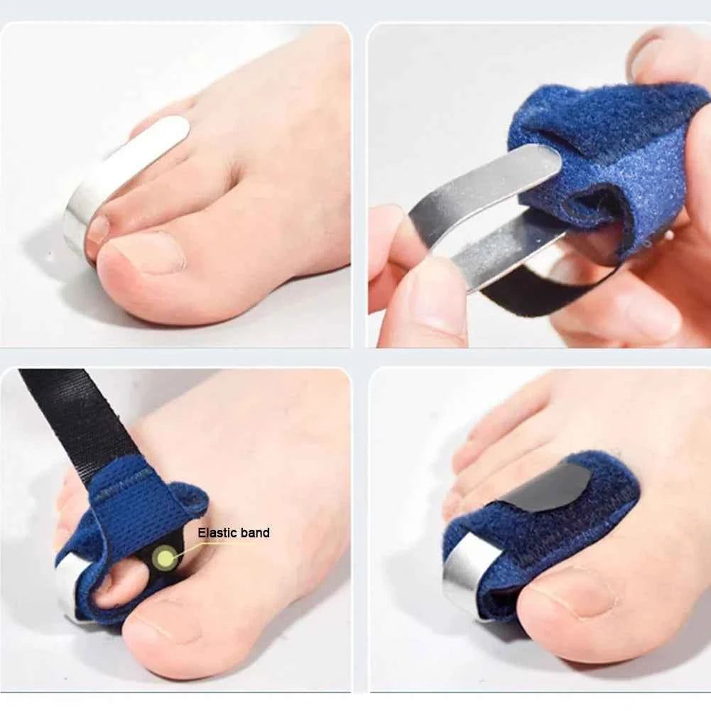 HammerToeFix™ Toe Splint Straightener – Hammer Toe Relief & Alignment