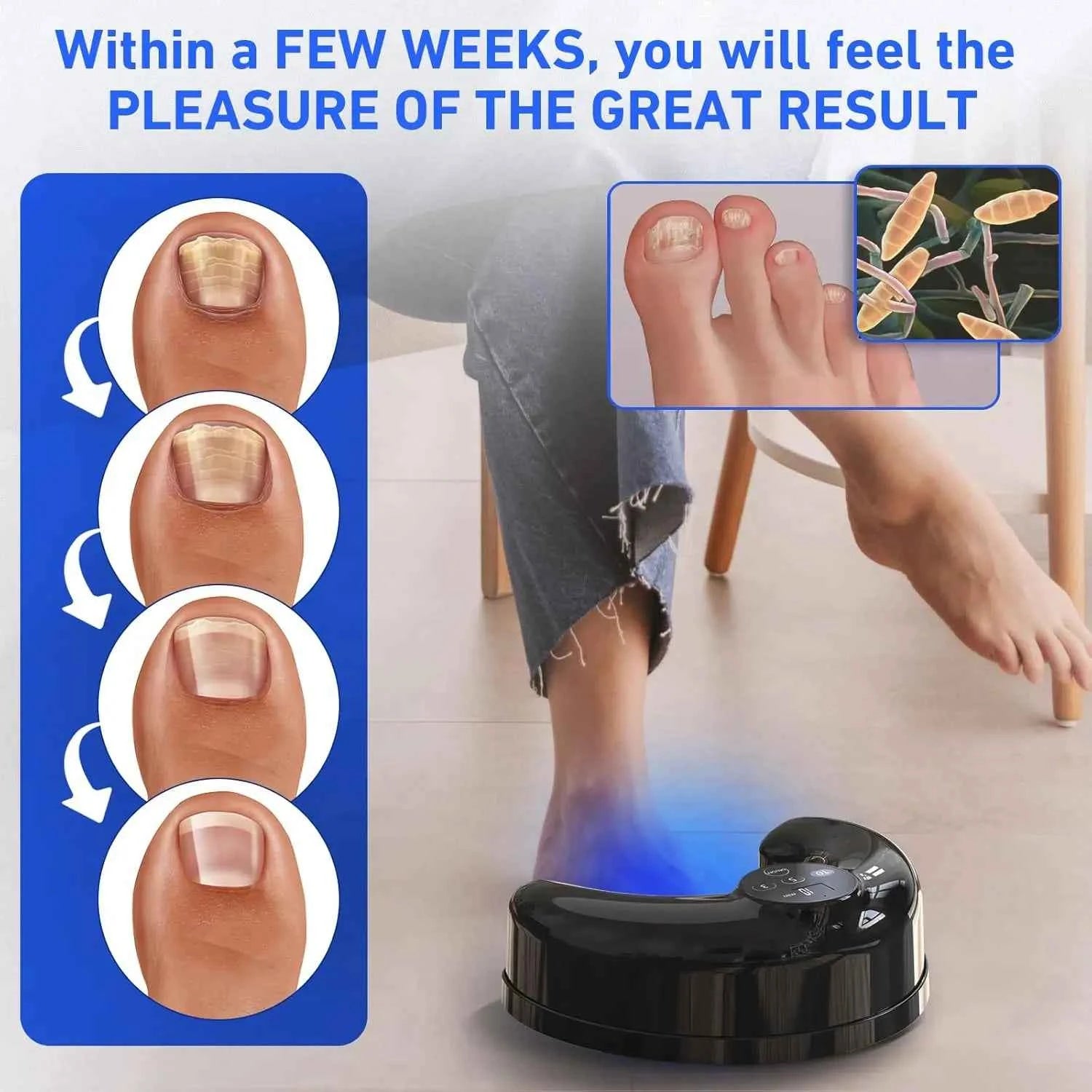 FungiClear™ Wireless Nail Fungus Laser – Foot Care & Nail Health