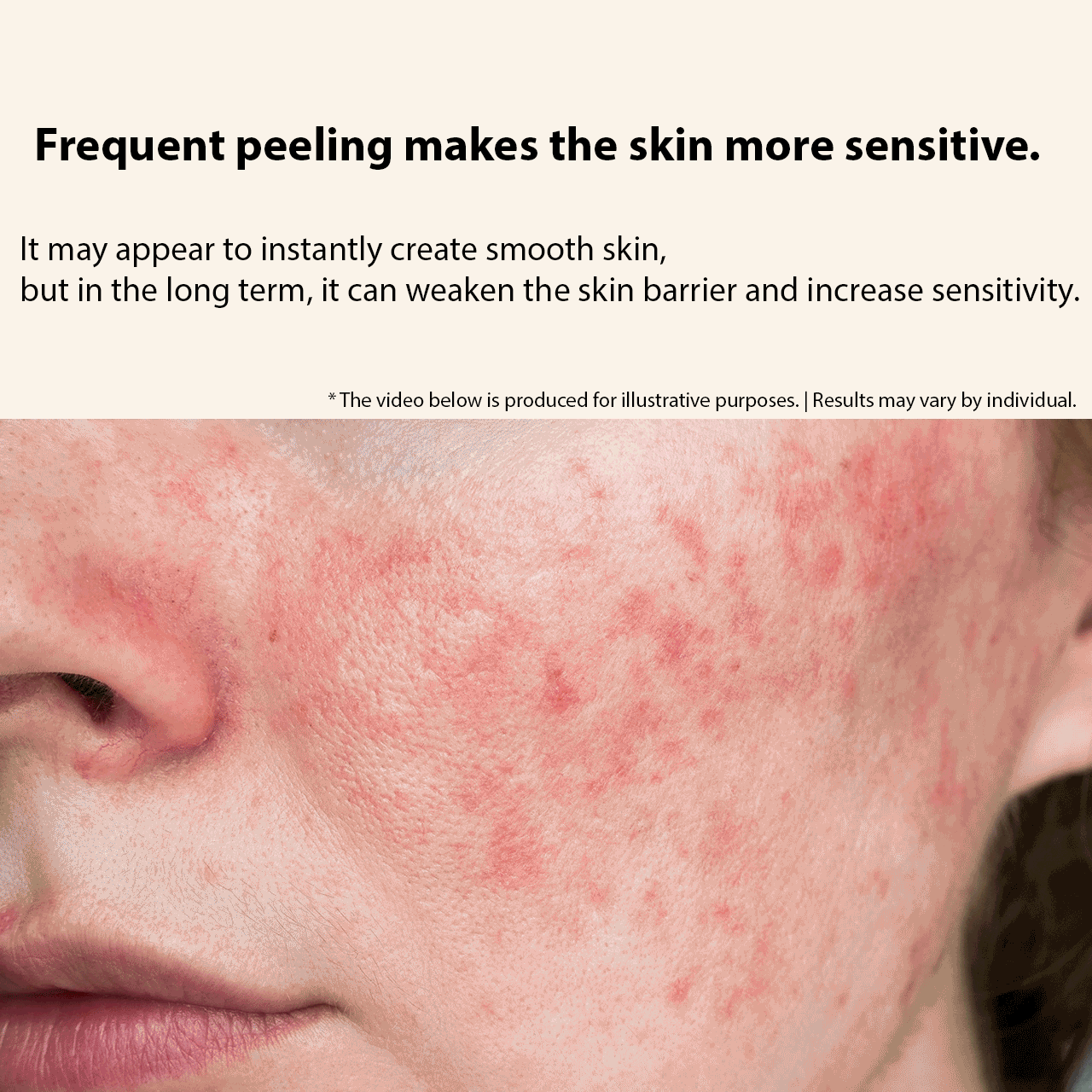 [ Vemontes ] Vemontes Orthomin C Vitaplant System | Brightening &amp; Renewal Care by Pi-Boo