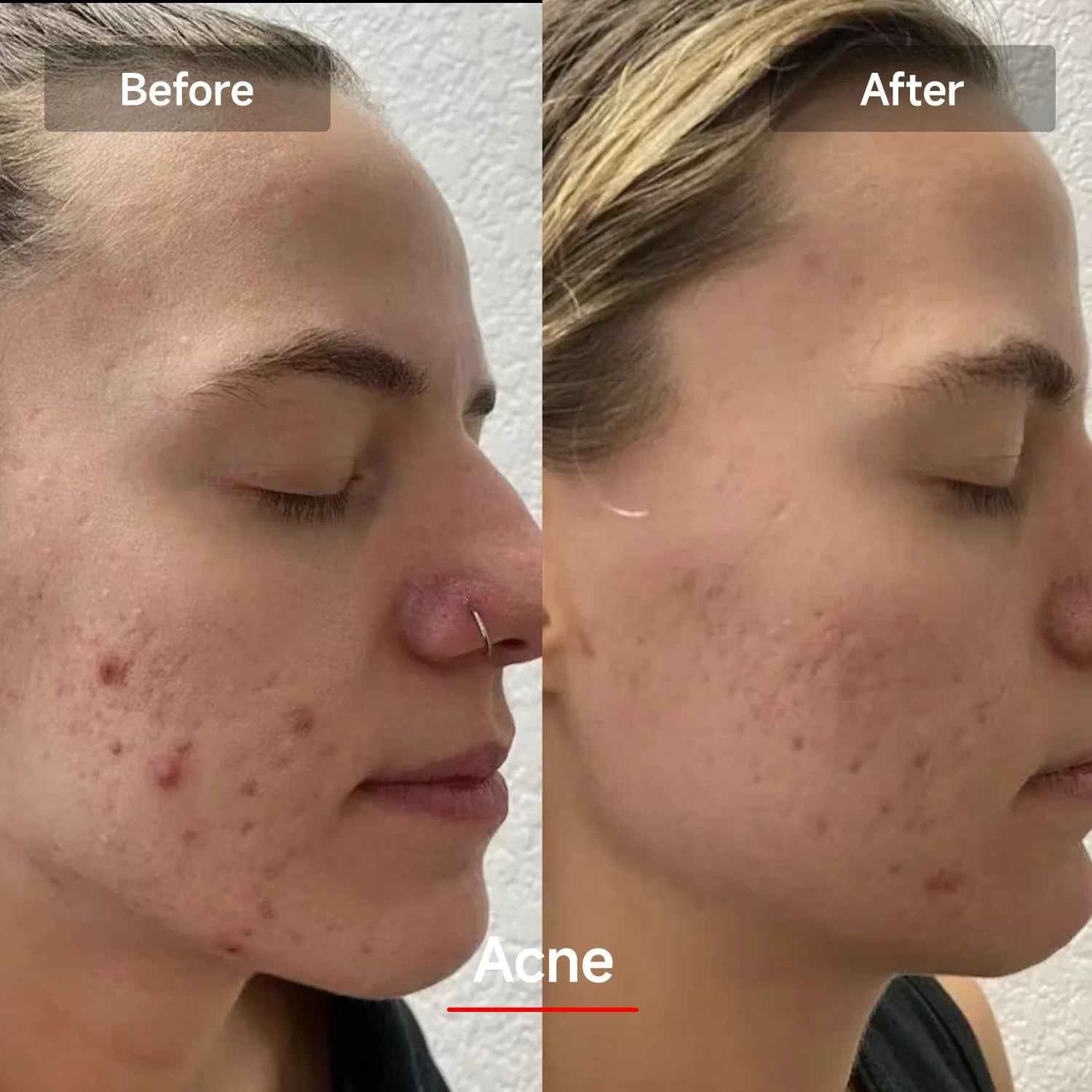 LED Red Light Therapy Mask