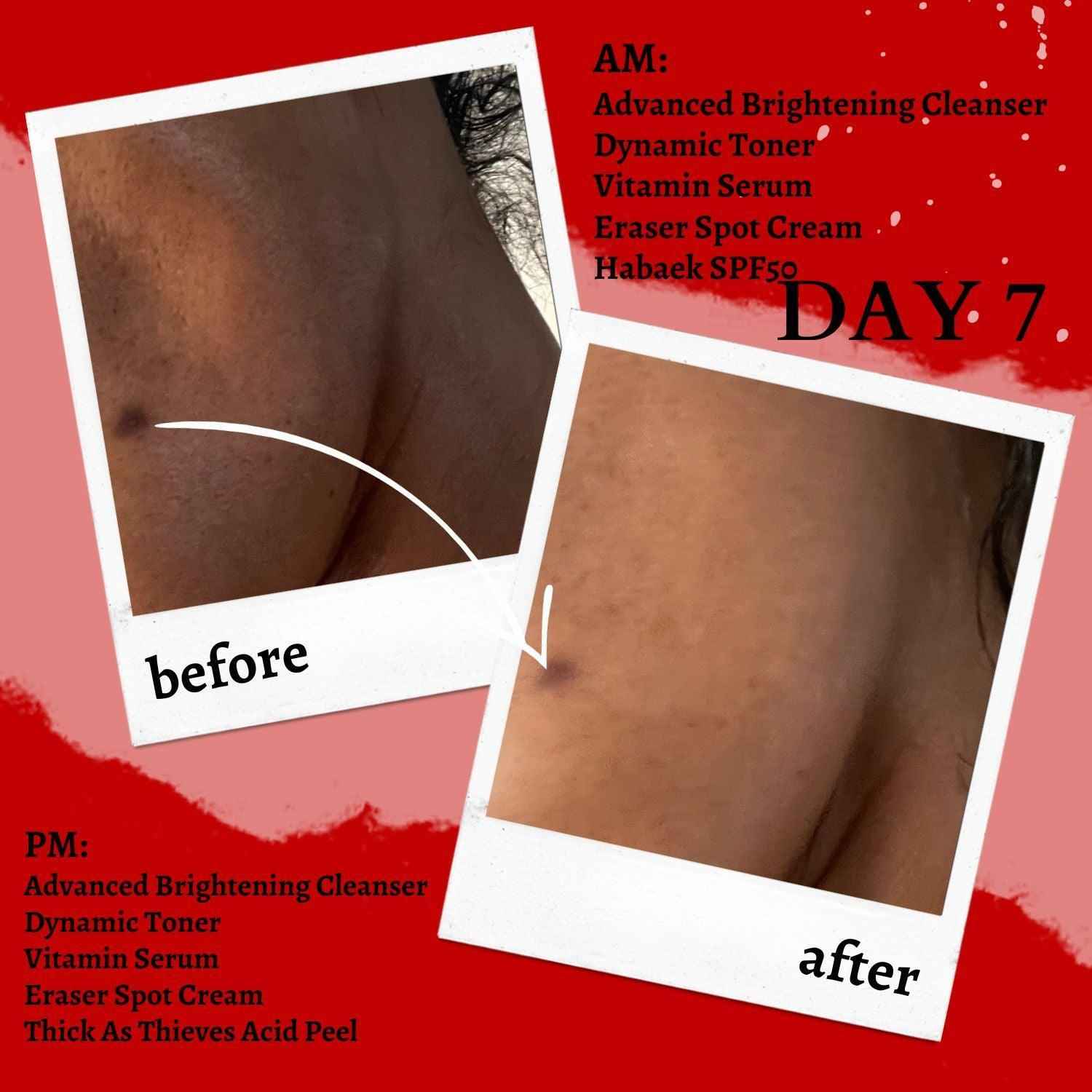 Thick As Thieves Pure Glycolic Acid Lactic Acid Extreme Gel Peel - 30ml