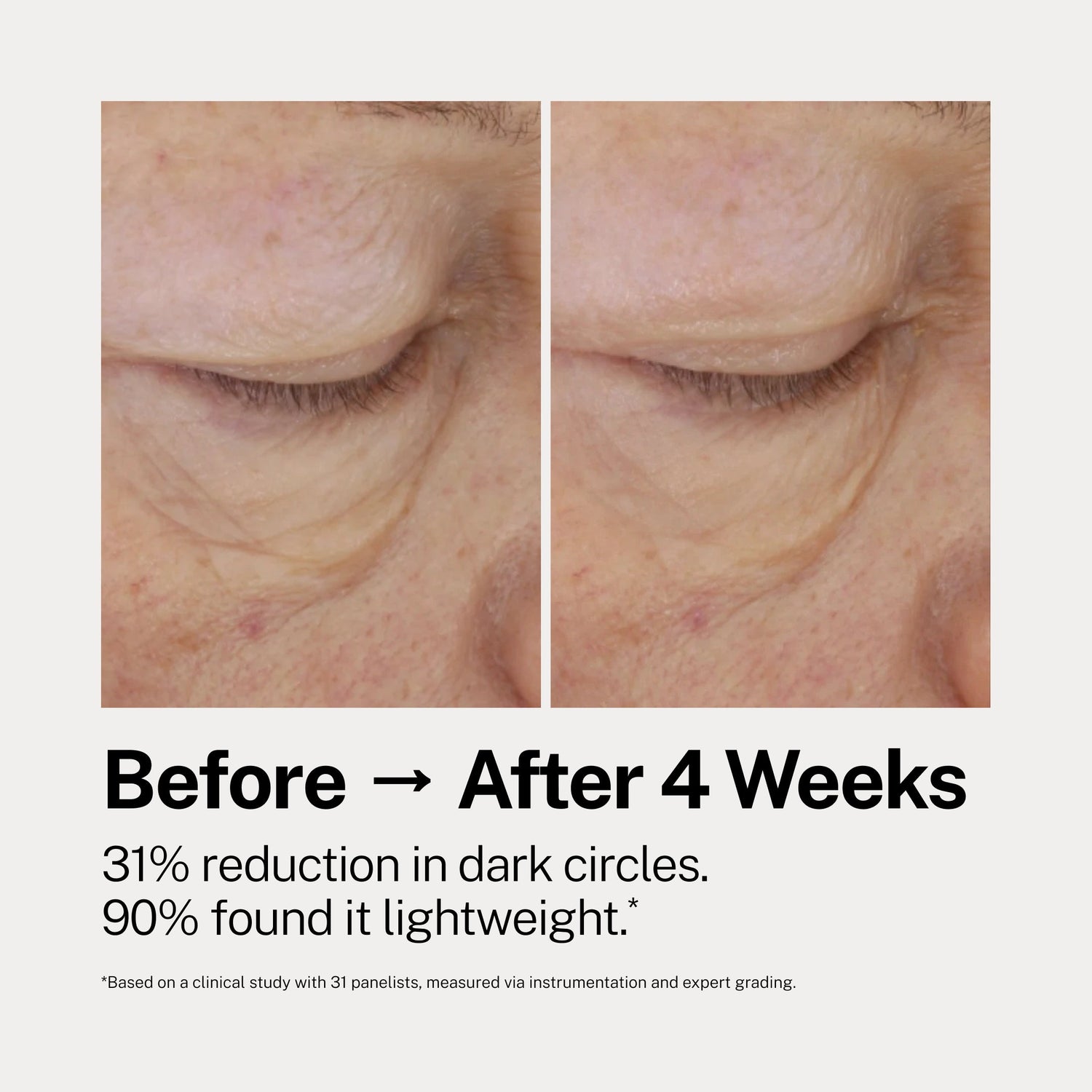 The Eye Cure by Dr Rossi