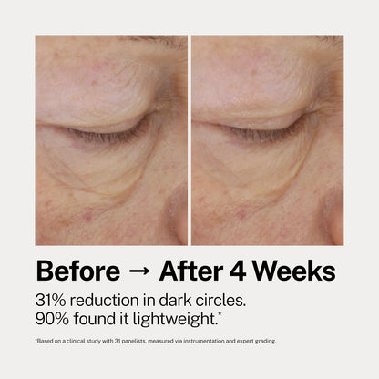 The Eye Cure by Dr Rossi