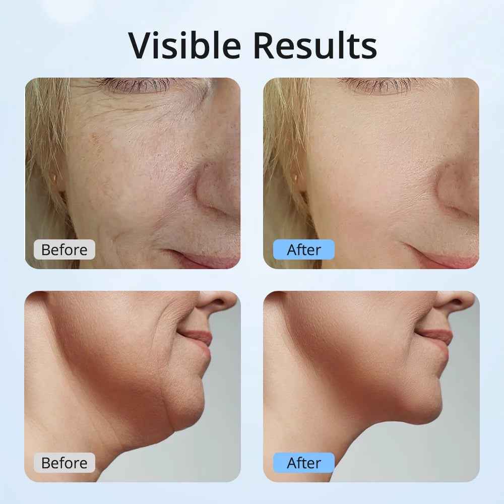 7 Color LED Neck Tightening Facial Device,Red Light Therapy for Face,Neck Lifting Device Face Massager for Face Lift, Facial Massager, anti Aging, 3 in 1 Portable Skin Care Tools, White