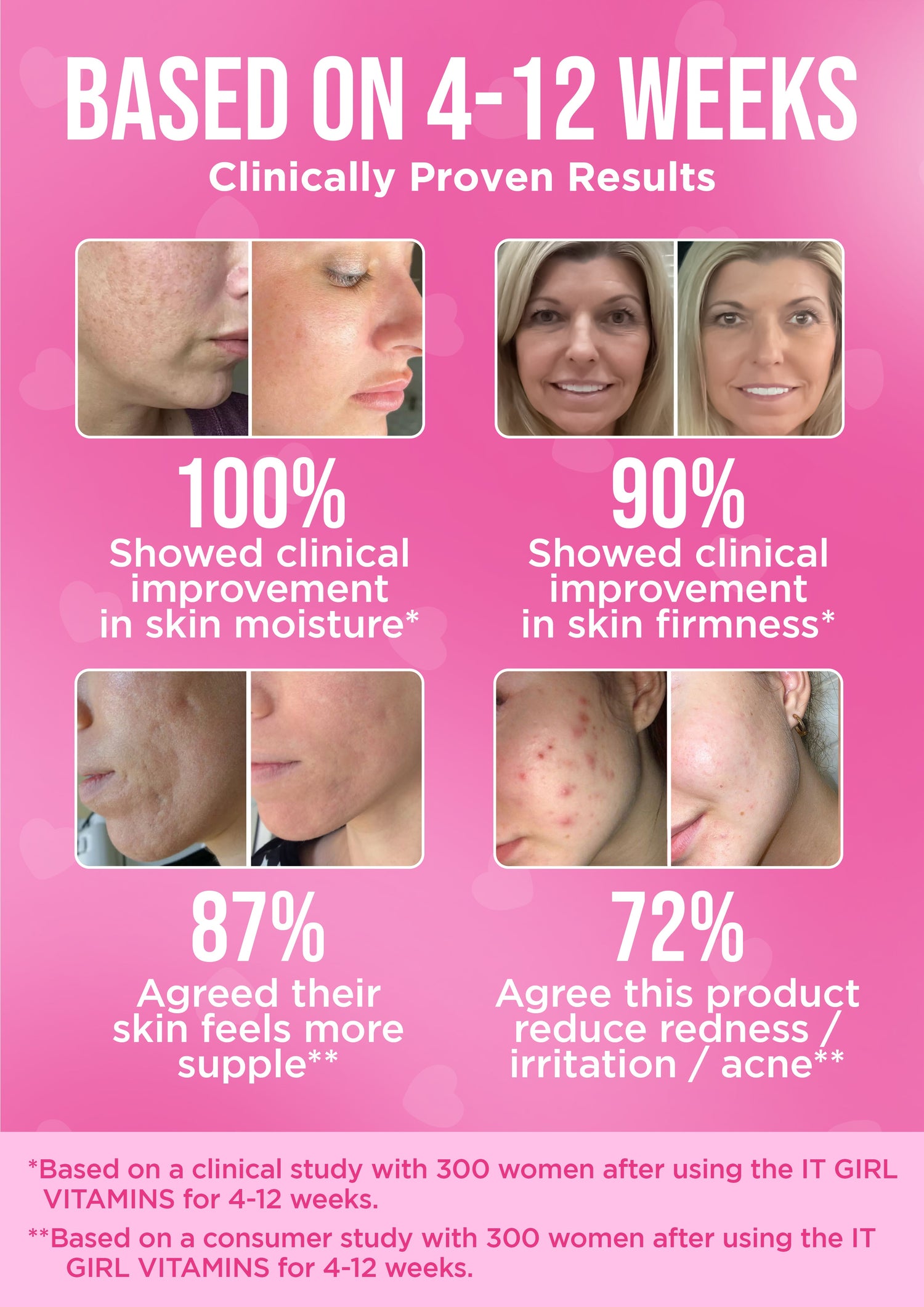 It Girl Skin – Skin Food by It Girl Vitamins