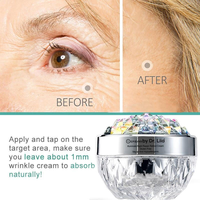 Anti-Aging Retinol Night Moisturizer – Hydrating, Vegan, Gluten-Free &amp; Radiance-Boosting by EpiLynx
