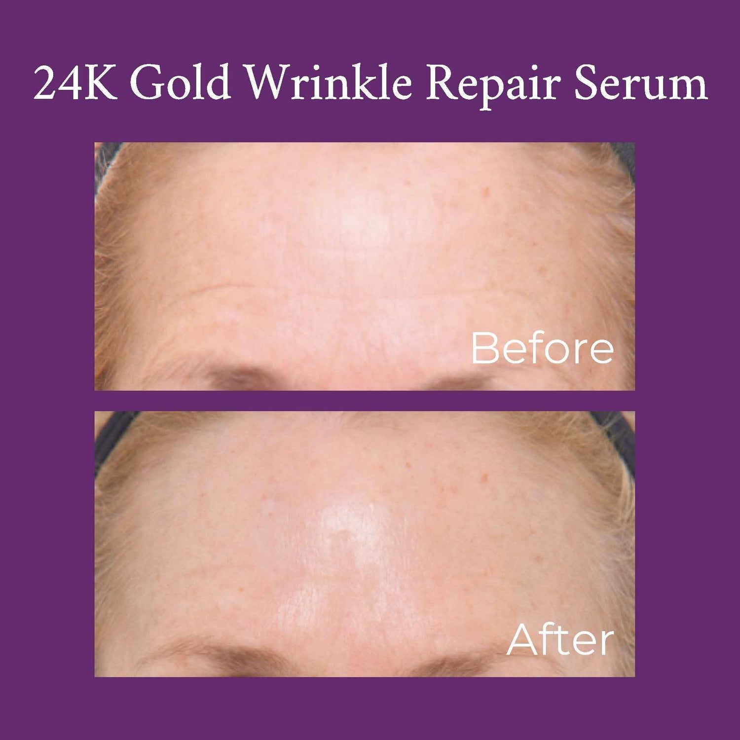 24K Gold Caviar Wrinkle Repair Serum