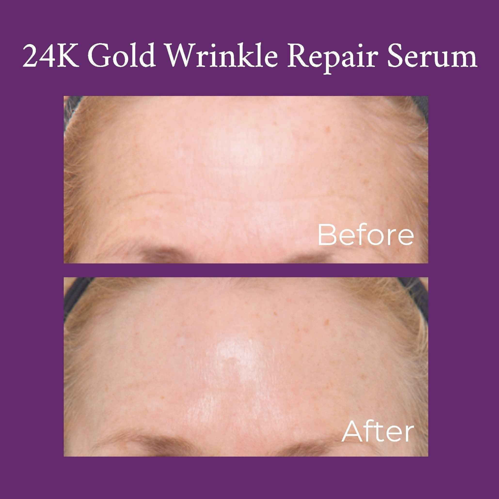24K Gold Caviar Wrinkle Repair Serum