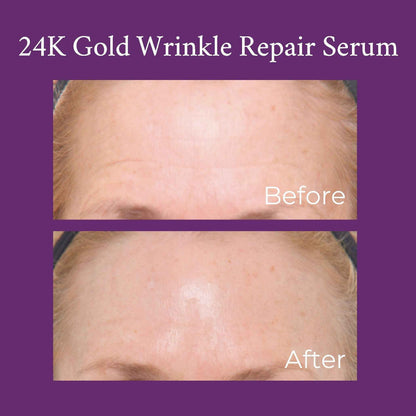 24K Gold Caviar Wrinkle Repair Serum