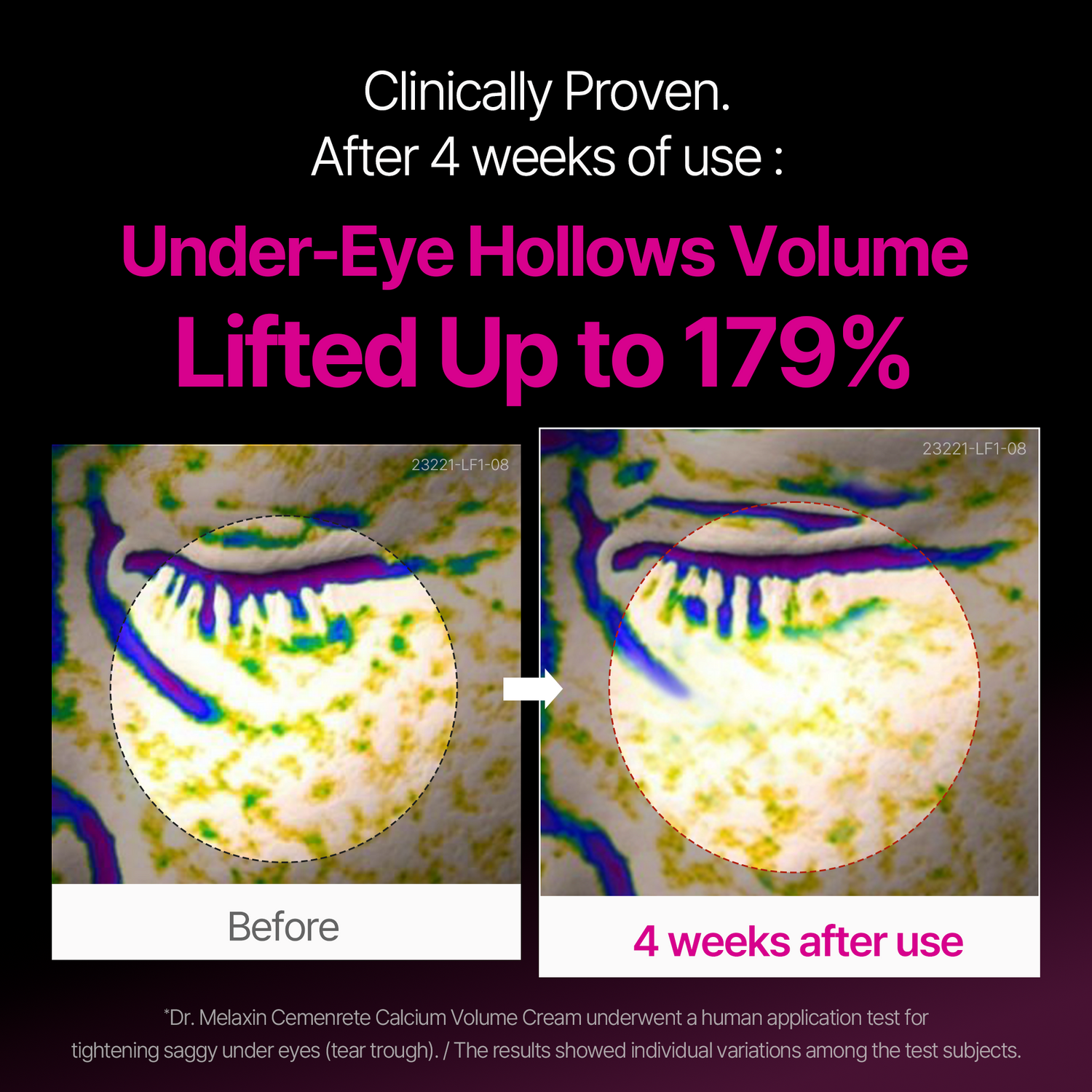 Dr. Melaxin Cemenrete Calcium Volume Ampoule Plus