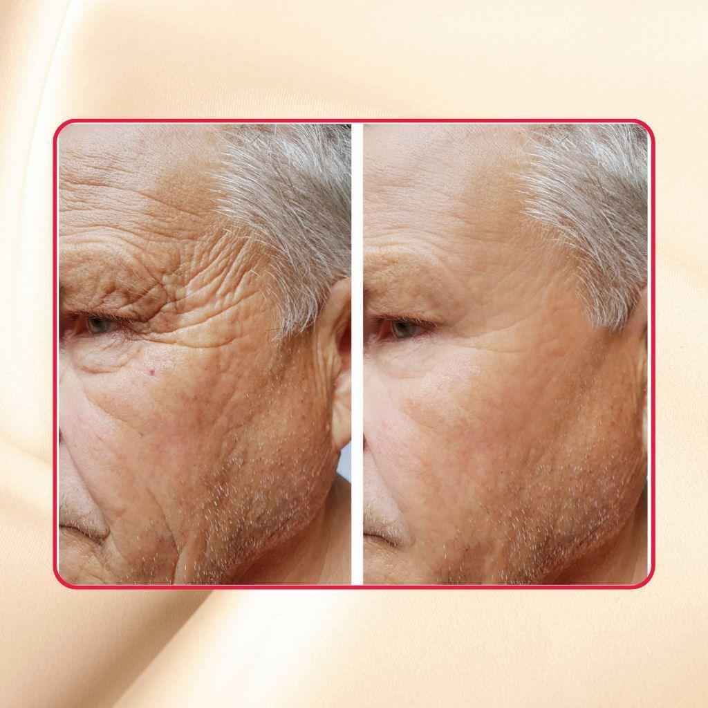 Thick As Thieves Pure Glycolic Acid Lactic Acid Extreme Gel Peel - 50ml