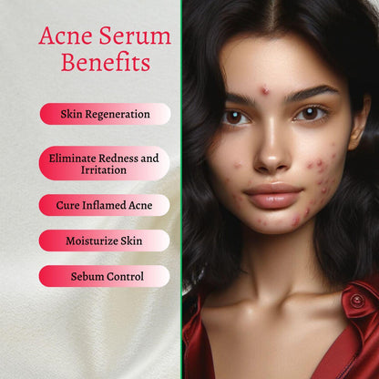 New Skin Natural Intensive Acne Serum by gymsegbë