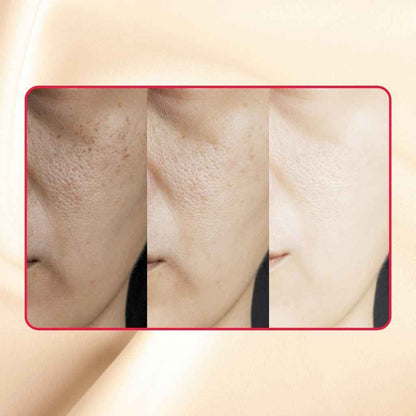 Thick As Thieves Pure Glycolic Acid Lactic Acid Extreme Gel Peel - 30ml