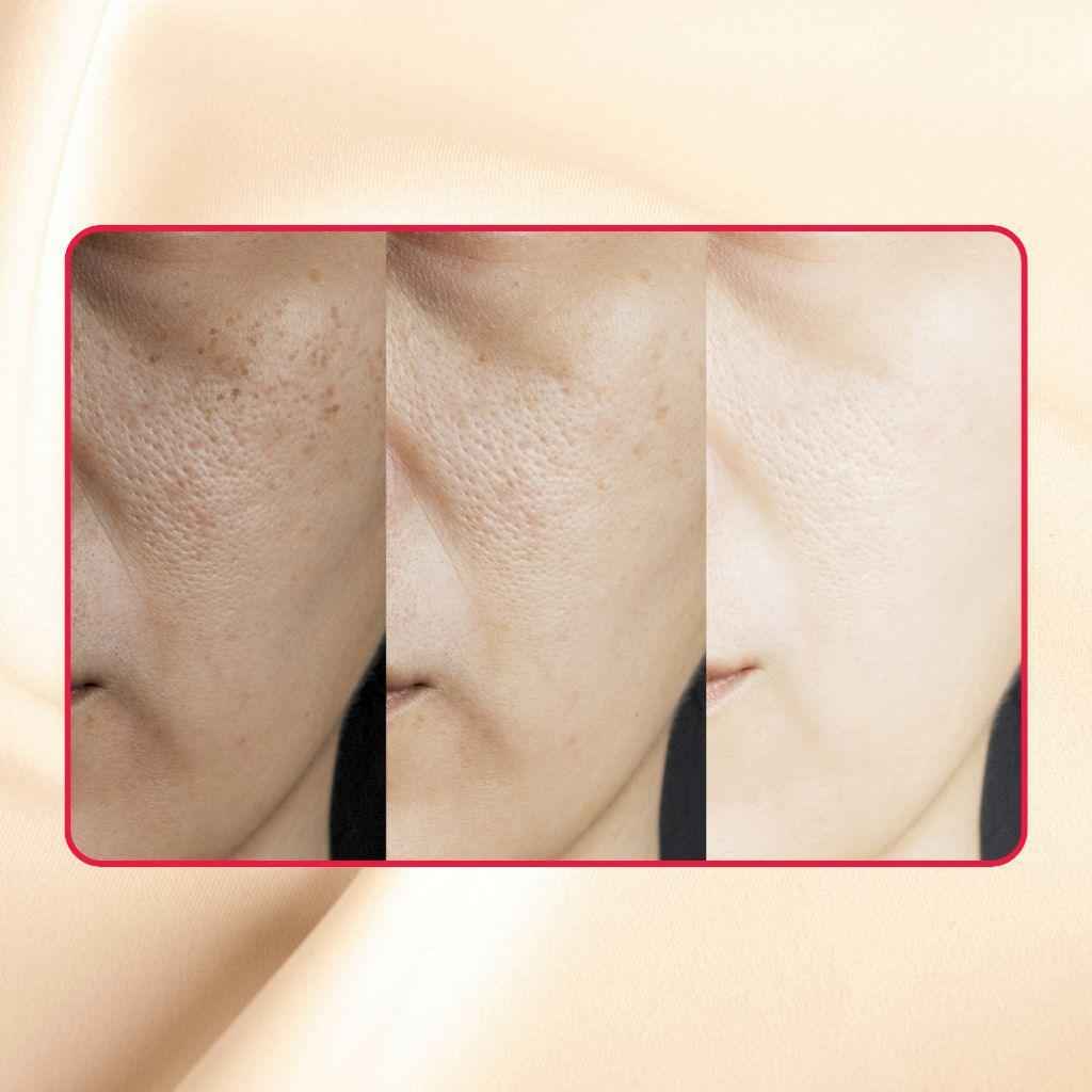 Thick As Thieves Pure Glycolic Acid Lactic Acid Extreme Gel Peel - 50ml