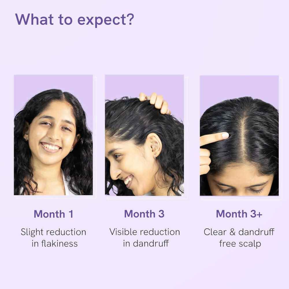 BeBodywise Anti Dandruff Hair Serum