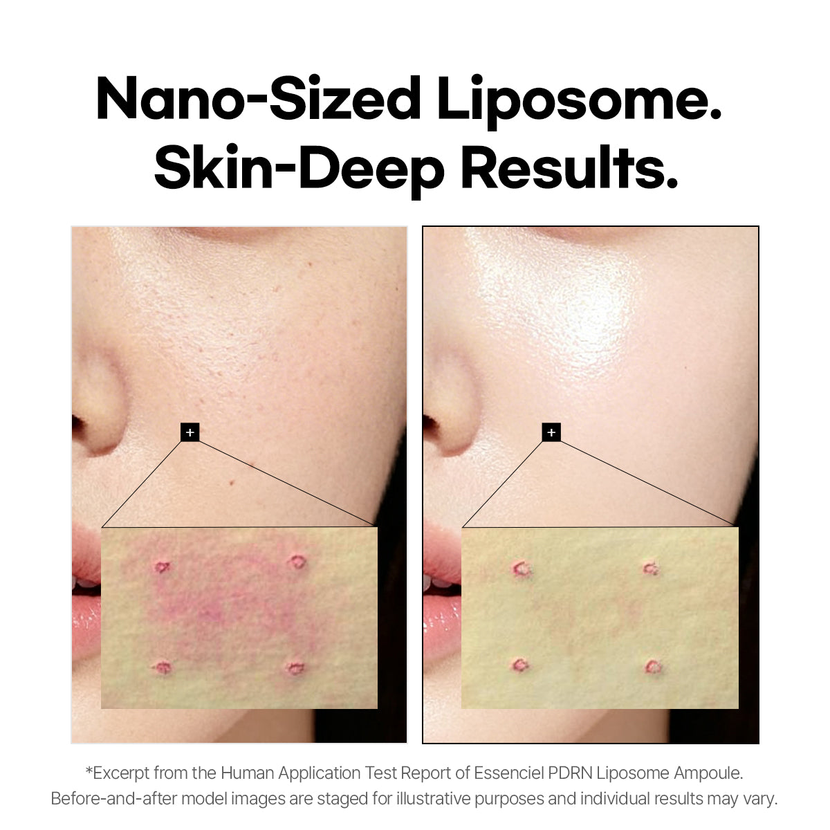 Essenciel PDRN Liposome Brightening Face Serum with Salmon DNA — Hydrating, Plumping &amp; Skin Renewal Serum for Fine Lines, Uneven Texture &amp; Dull Skin | 30ml
