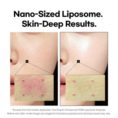 Essenciel PDRN Liposome Brightening Face Serum with Salmon DNA — Hydrating, Plumping &amp; Skin Renewal Serum for Fine Lines, Uneven Texture &amp; Dull Skin | 30ml