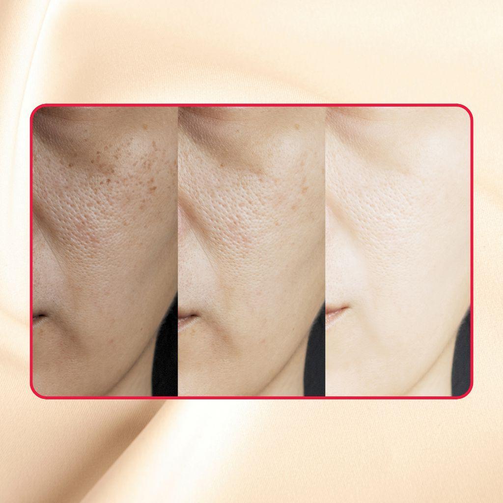 Thick As Thieves Pure Glycolic Acid Lactic Acid Extreme Gel Peel - 30ml by gymsegbë