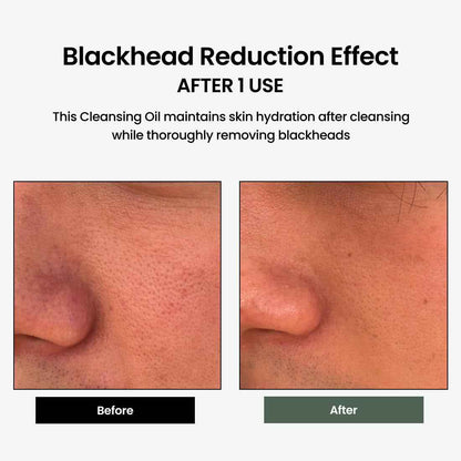 Liposome Daily Cleansing Oil, Gentle Makeup &amp; Blackhead Remover for Sensitive Skin with Centella Asiatica TECA, Korean Skincare for Trouble Care (6.76 Fl. Oz., 200Ml)