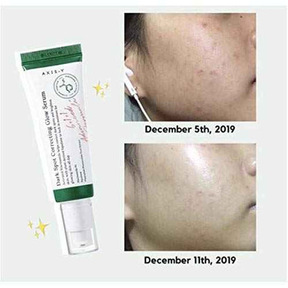 AXIS-Y Dark Spot Correcting Glow Serum