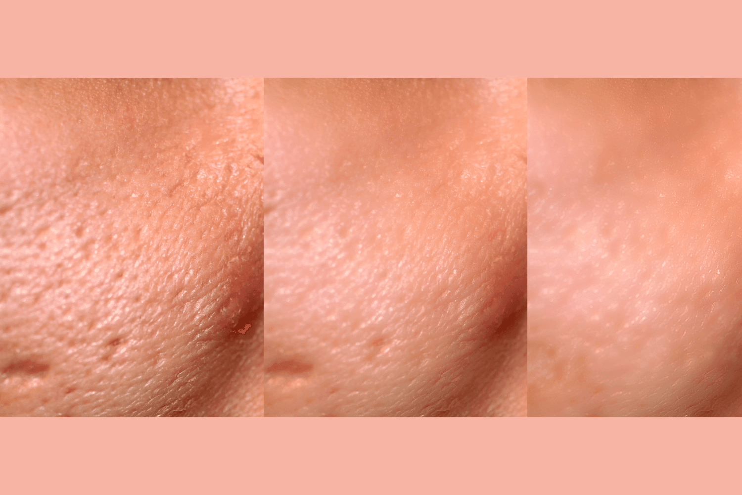 Ultra-Advanced Anti-Aging Daily Resurfacing Pads - DestGlow