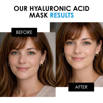 Hyaluronic Acid Mask 50ml by skinChemists US