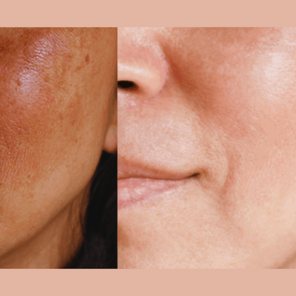Ultra-Advanced Anti-Aging Daily Resurfacing Pads - DestGlow