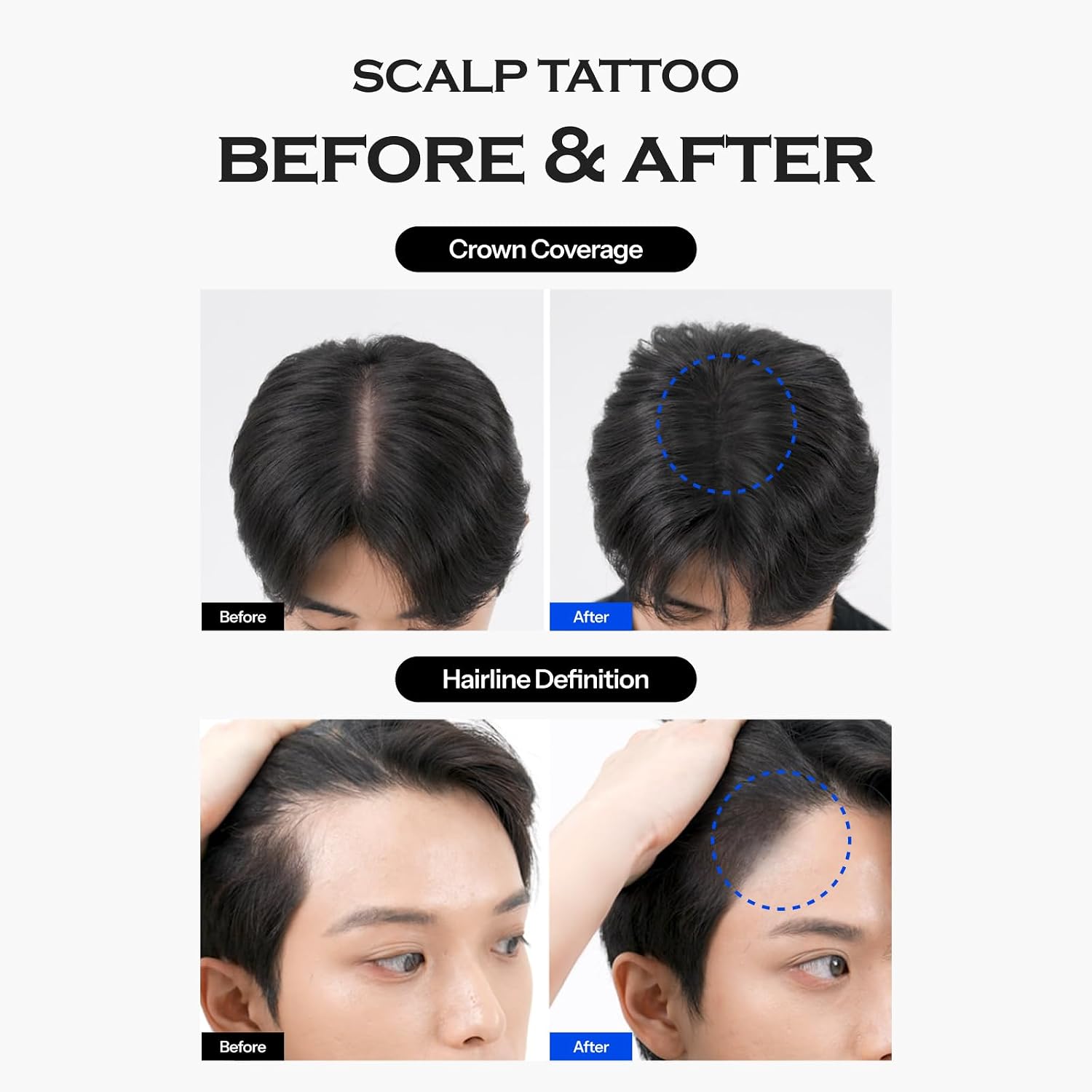 FORBEAUT Scalp Tattoo (Black)  DestGlow