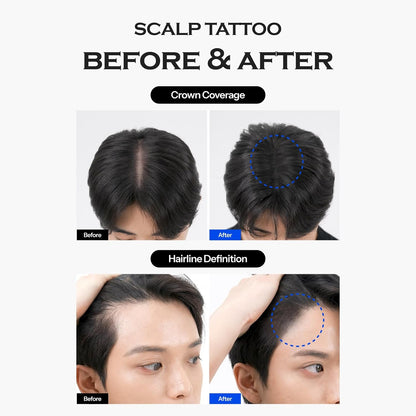 FORBEAUT Scalp Tattoo (Black)  DestGlow