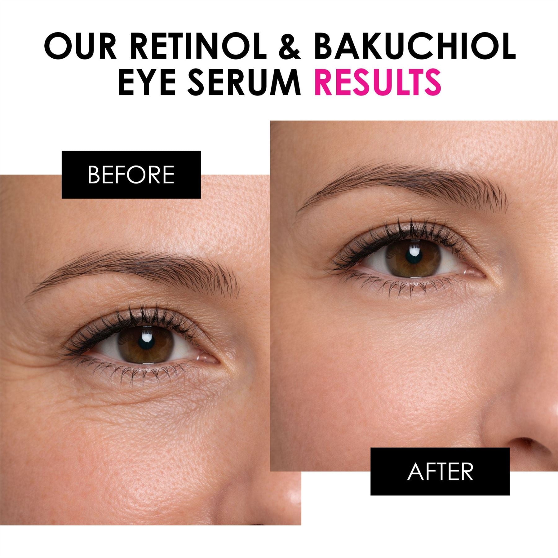 Retinol &amp; Bakuchiol Eye Serum 15ml  DestGlow