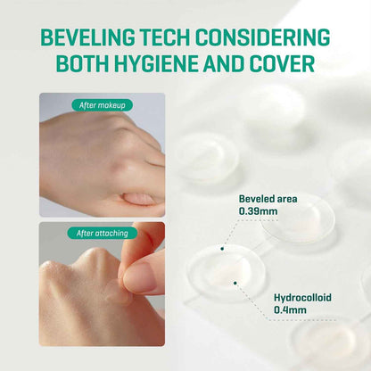 SOME BY MI Clear Spot Patch