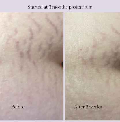 Revitalize Postpartum Cream 4oz