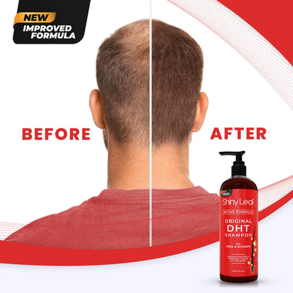 Bariatric Multivitamin Iron Free With DHT Original Shampoo and Conditioner Hair Care Bundle by Shiny Leaf
