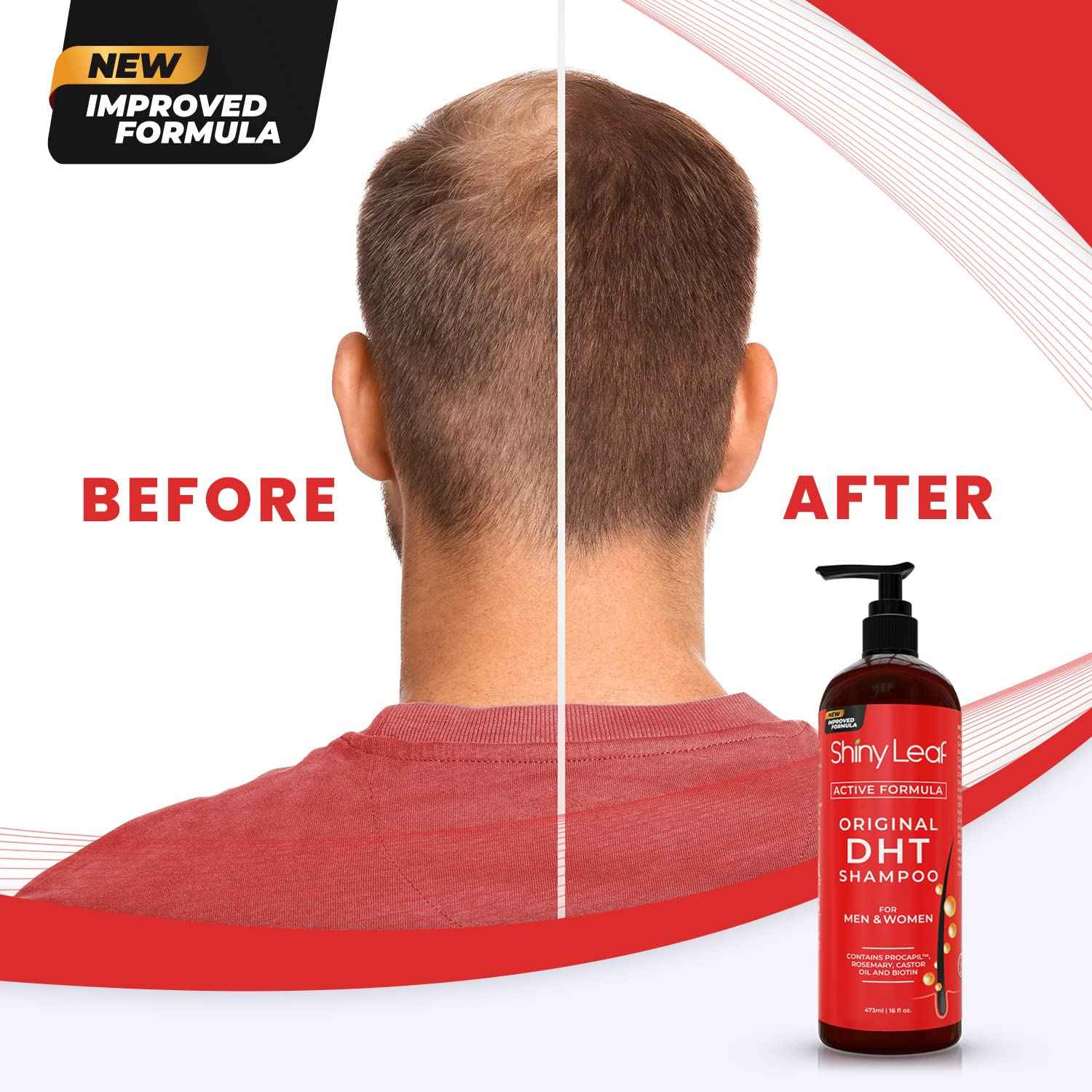 DHT Blocker Anti Hair Loss Shampoo and Conditioner set with Biotin (2 x 16 Oz)