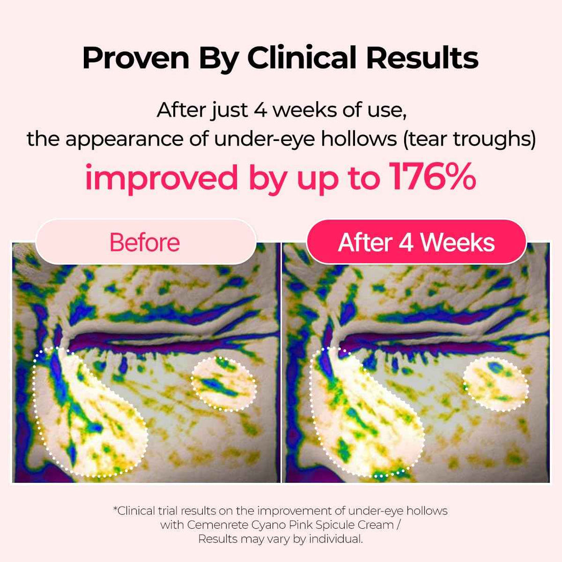 Dr. Melaxin Cemenrete Cyano Pink Spicule Cream