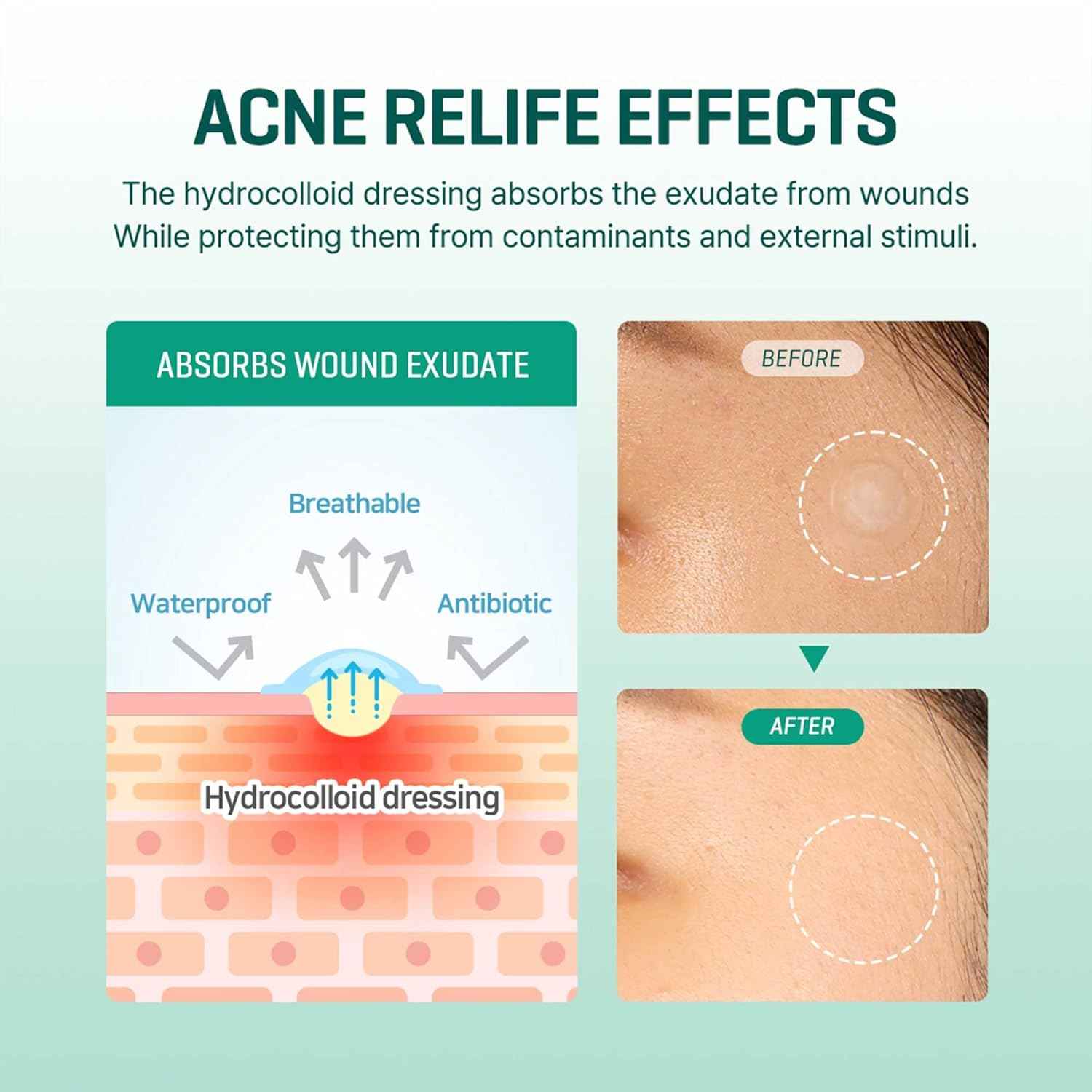 SOME BY MI Clear Spot Patch