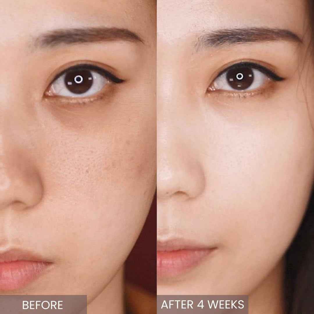 Retinol Serum/Skin Moisturizer/Facial Moisturizers/ Official/Korean Cosmetics/Korean Skin Care/Retinol