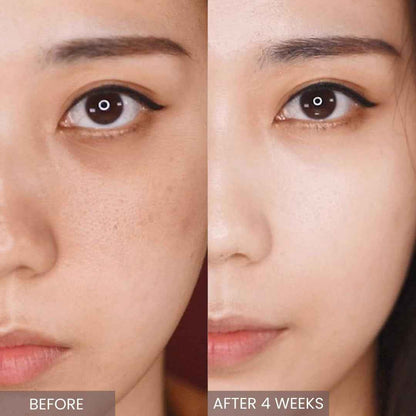 Retinol Serum/Skin Moisturizer/Facial Moisturizers/ Official/Korean Cosmetics/Korean Skin Care/Retinol